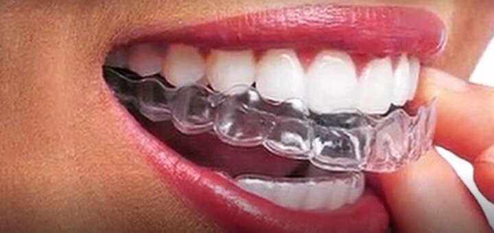 Promotions in the dental clinic &quot;smile factory in ivano-frankivsk&quot;