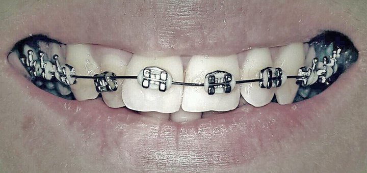 Promotion for dentistry in the clinic of aesthetic medicine «Ex Tempore»