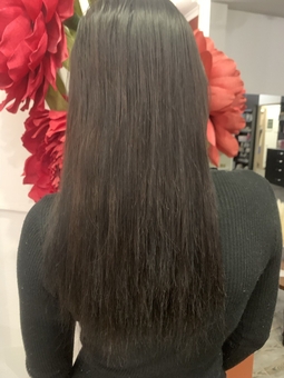 Hair restoration (before photo)