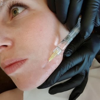 Bugaeva Olga косметолог в Киеве. Записывайтесь на биоревитализацию по акции.